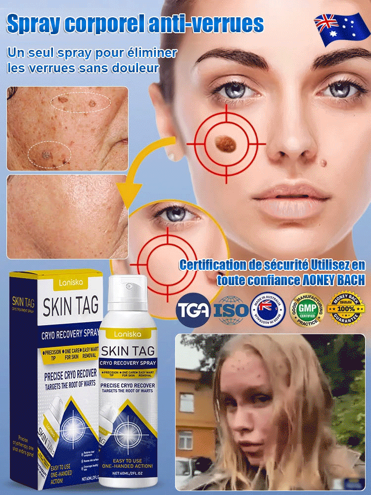 LANISKA spray de soin topique pour points de verrues