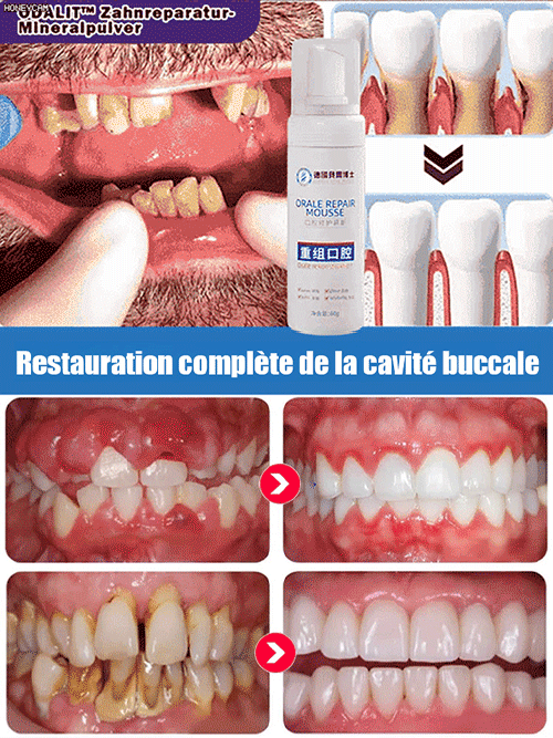 Mousse Réparatrice Buccale de Qualité Médicale