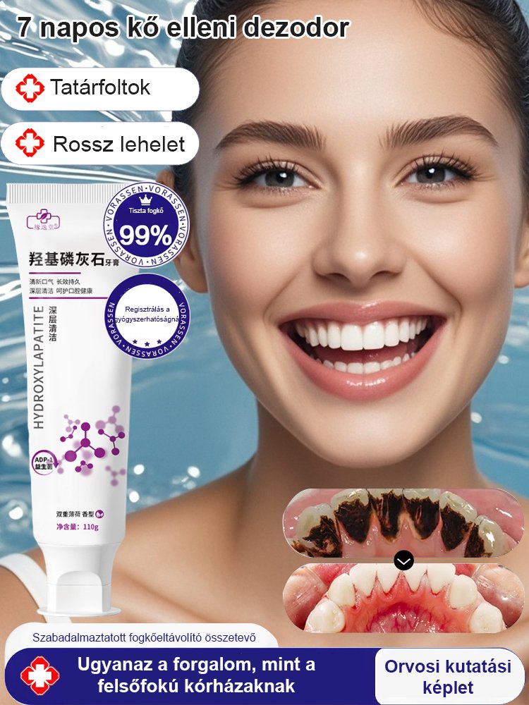 【3 nap alatt eltávolítja a fogkövet】Hidroxiapatit fogkrém