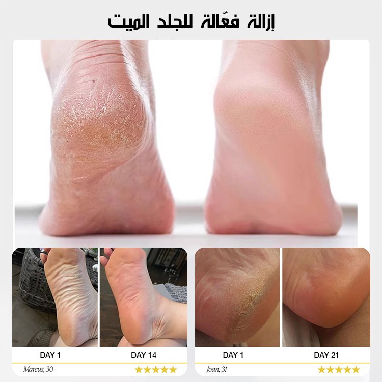 مبرد القدم الكهربائي