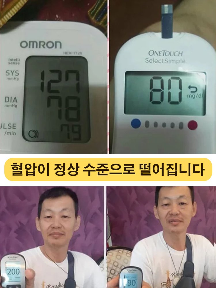 혈당강하 및 항고혈압 크림향 노란 과육 분재 페피노 멜론 