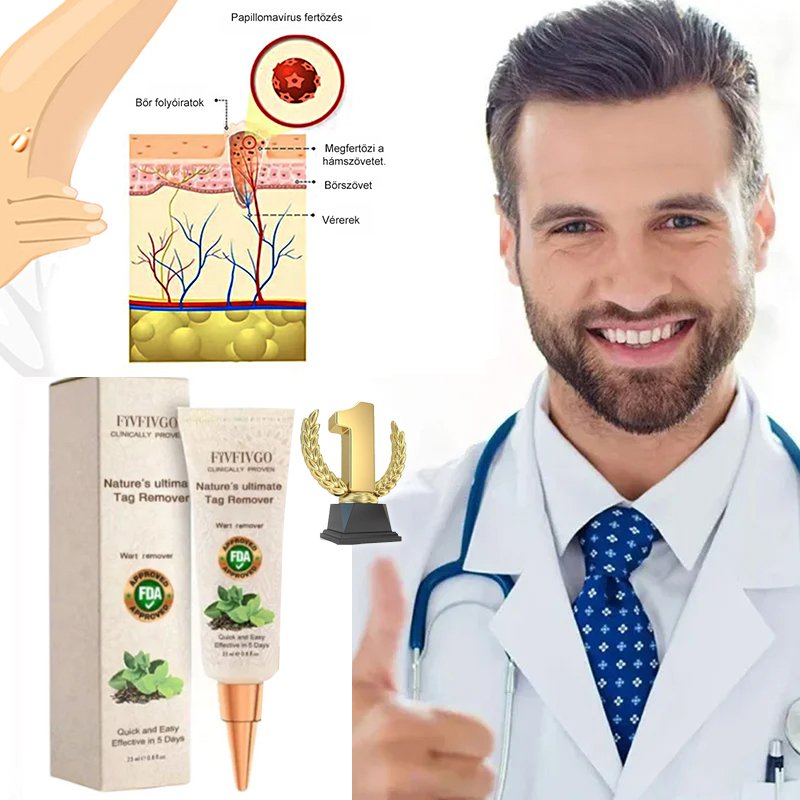 Eelhoe szemölcseltávolító kenőcs