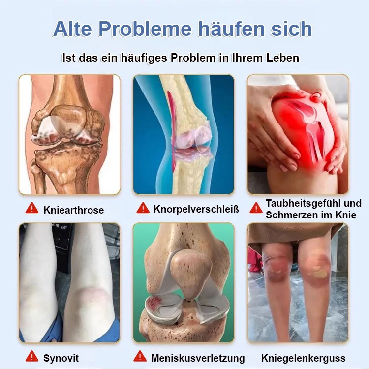 Bienengift-Gelenkpflegesalbe