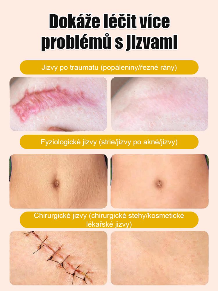 Včelí jed krém na vyhlazení jizev na pokožce