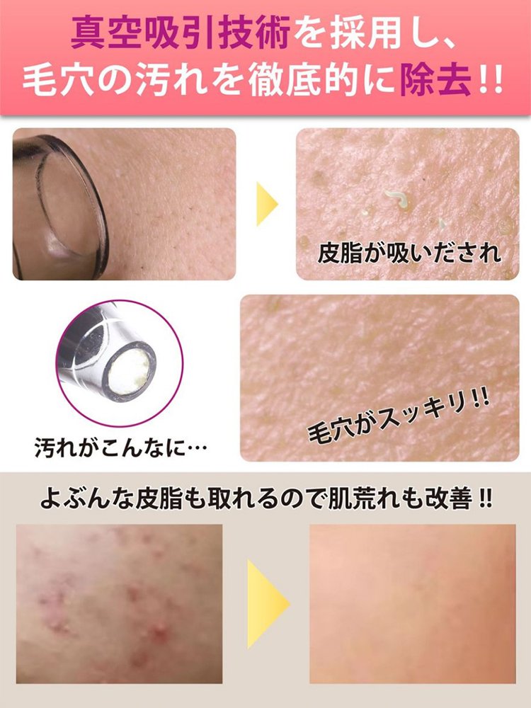 ポータブル 毛穴吸引器