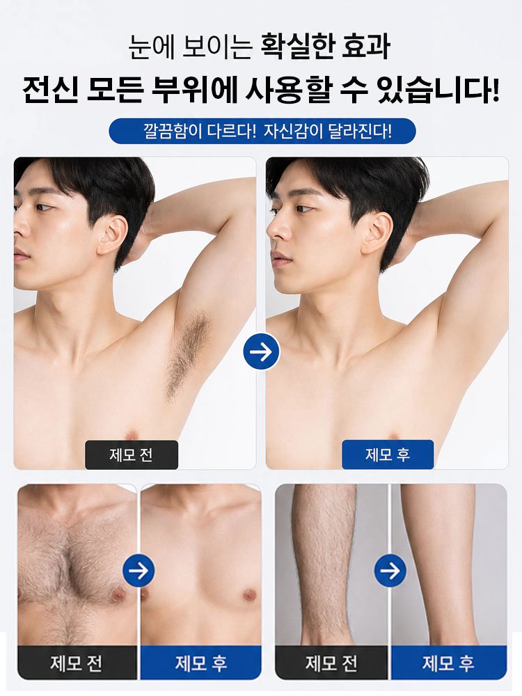 전신용 무통 제모기