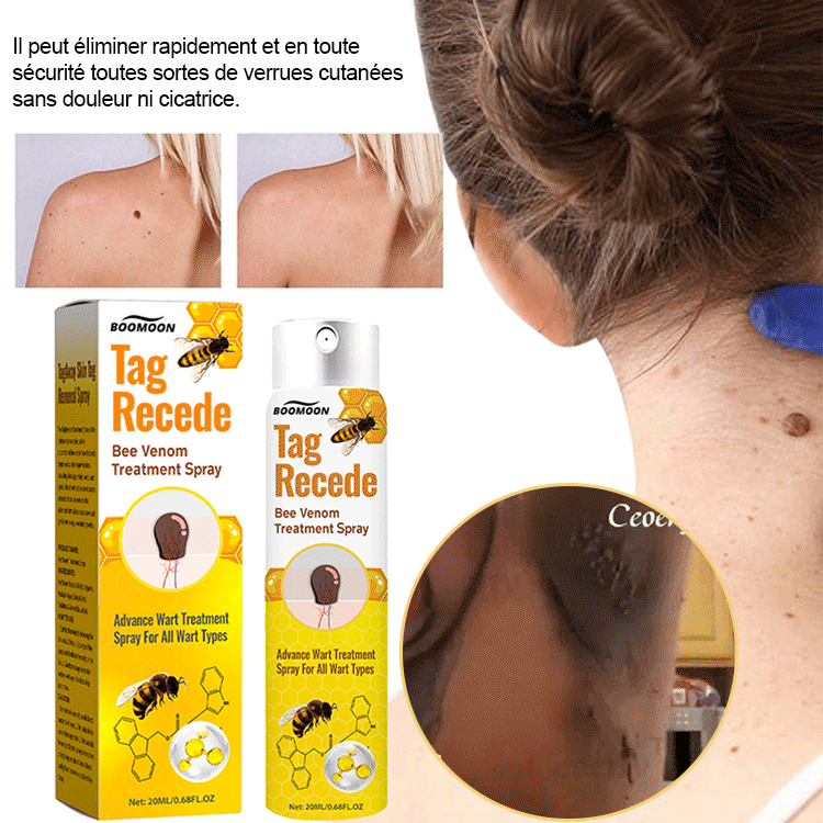 BOOMOON Spray de soin pour verrues au venin d'abeille