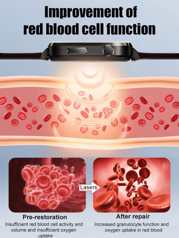 Smart Non-invasive Blood Glucose Uric Acid Watch