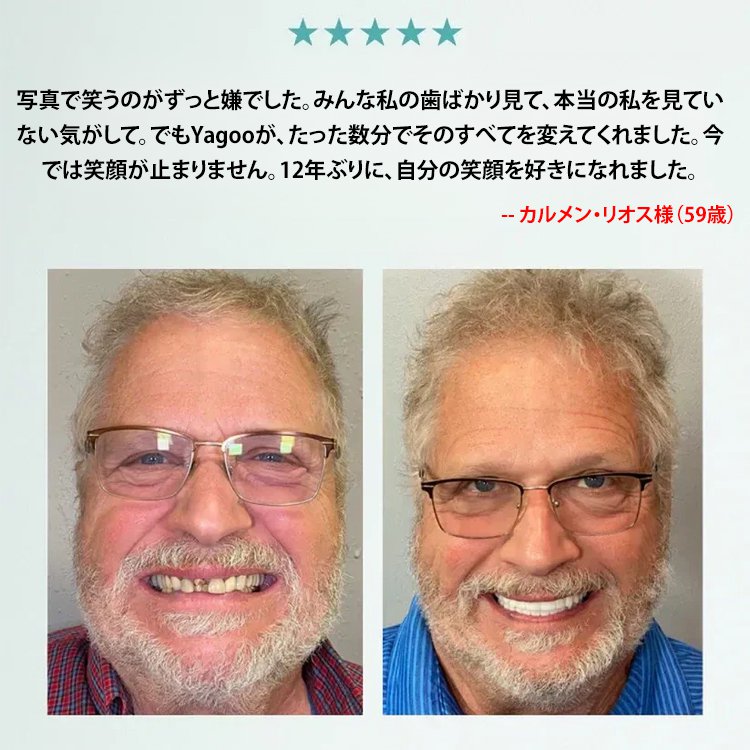 【オールインカスタムモデル】入れ歯セット