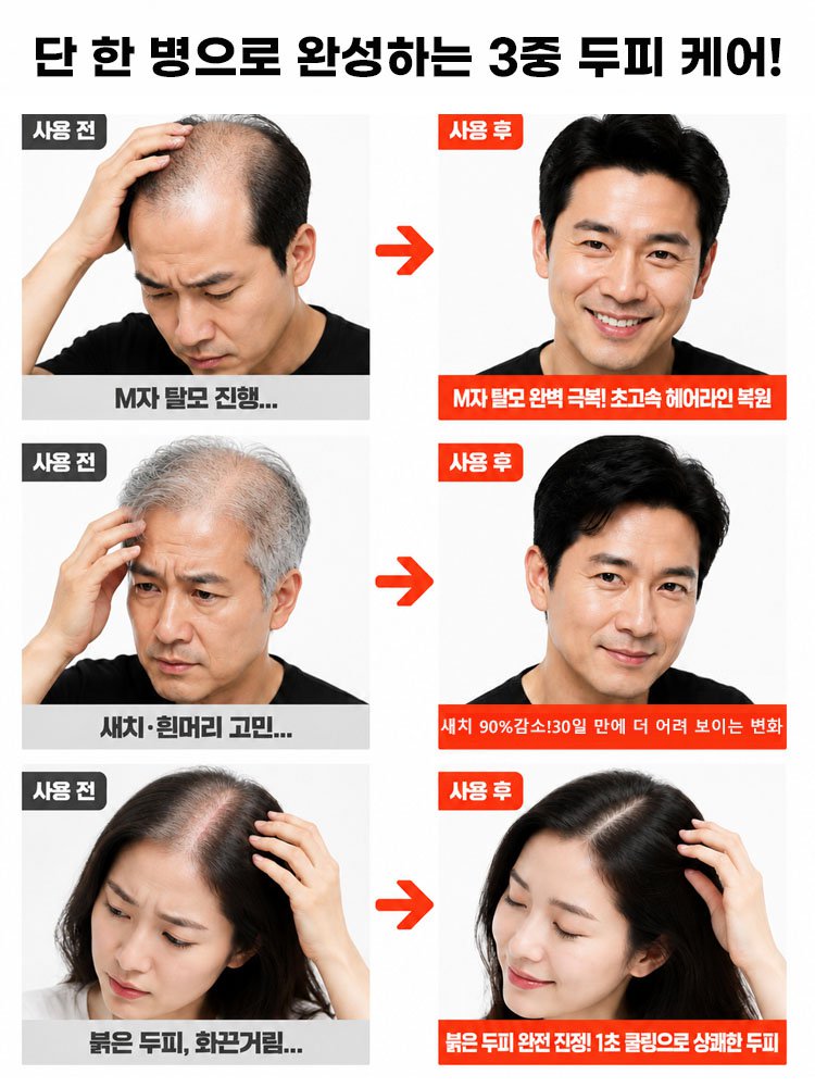 집중 모발 케어 에센스