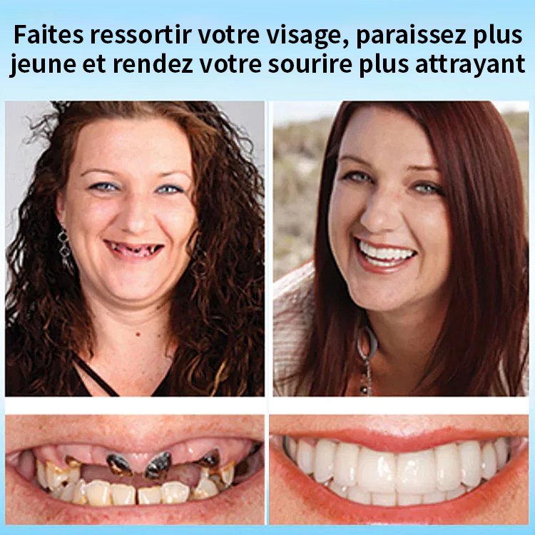 Ensemble de retouche dentaire oralhoe (colle d'alimentation)