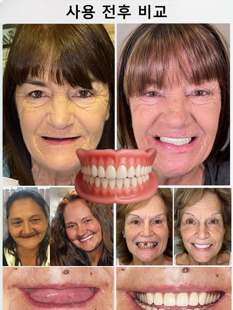 자연스럽게 밀착되는 풀커버 틀니 케어 세트