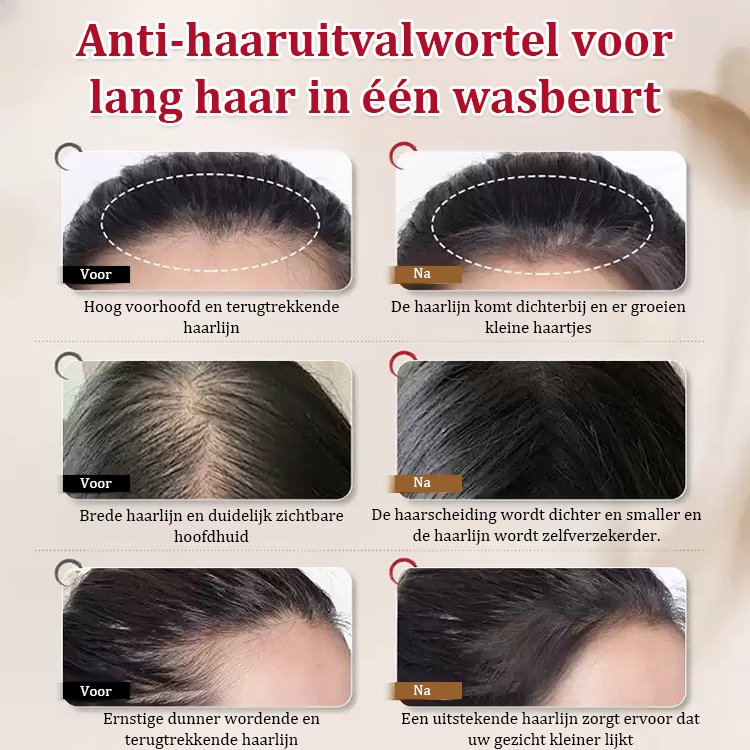 Gember verstevigende en haargroei bevorderende shampoo