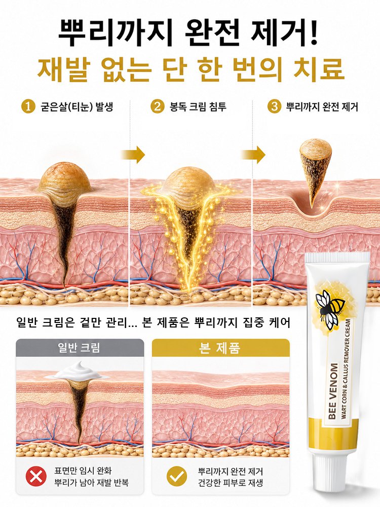 딱딱한 티눈과 굳은살을 싹 녹여주는 매끈 발 크림