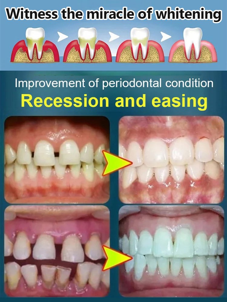 Dental care kit