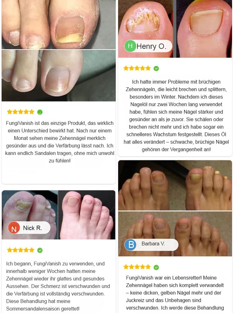 [Zurück zu Ihren gesunden Nägeln] Nail Repair Care Essence