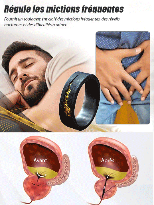 Anneau de traitement de la prostate à motif gaufré