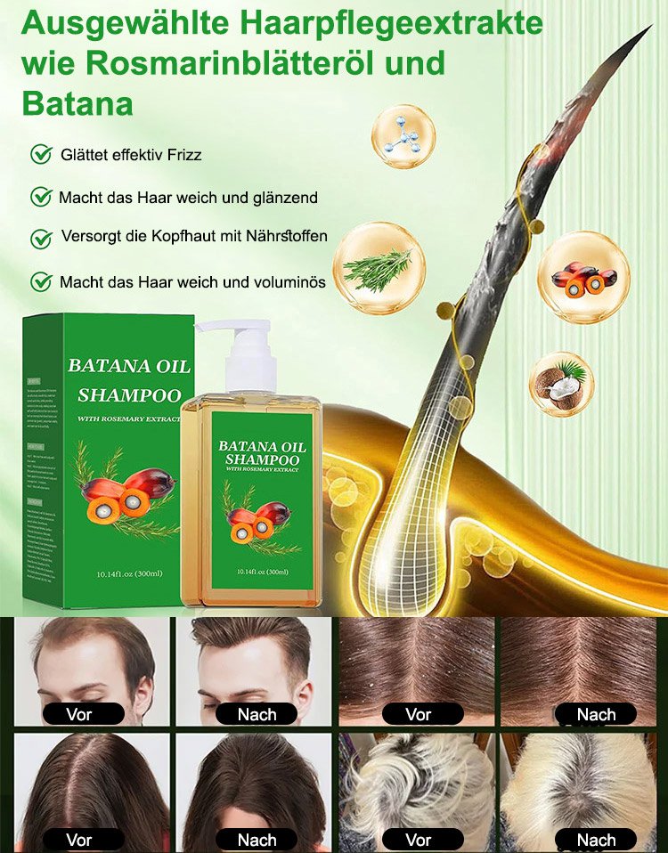 【Rapid hair growth in 7 days!】Hair growth shampoo