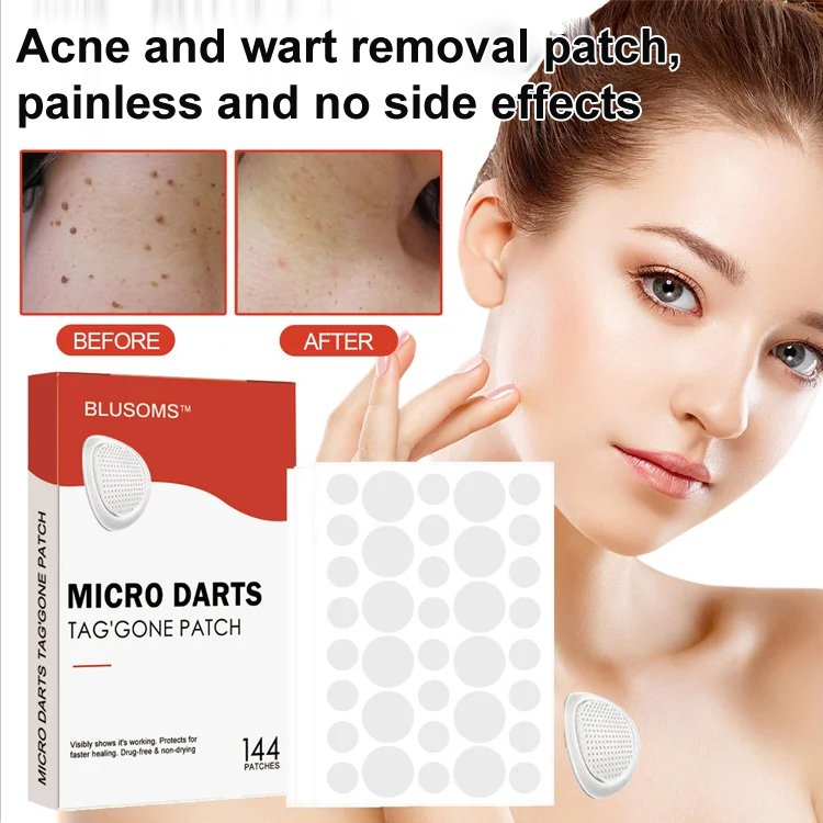Plaster