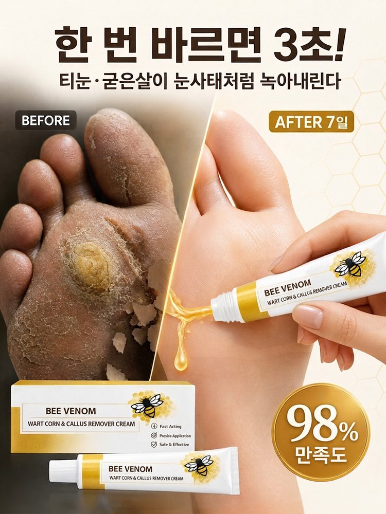 딱딱한 티눈과 굳은살을 싹 녹여주는 매끈 발 크림