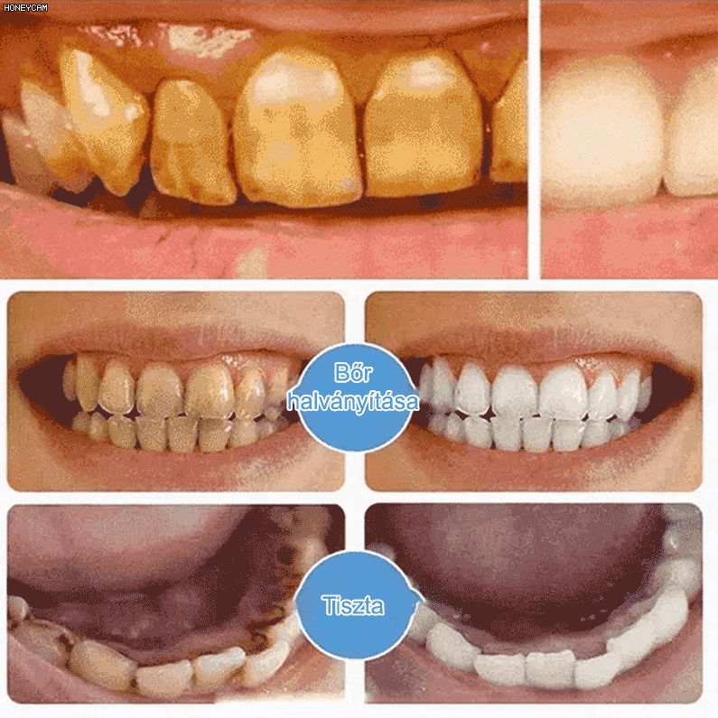 Jaysuing fehérítő fogkrém