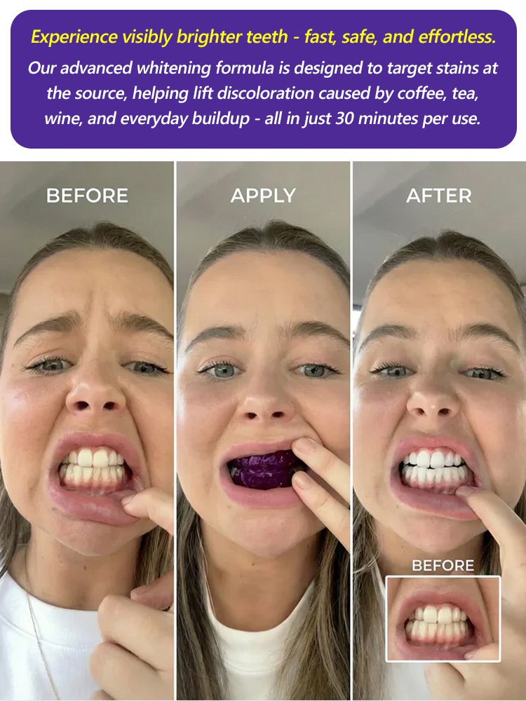 【At-Home Dental Whitening】Instant Whitening Strips