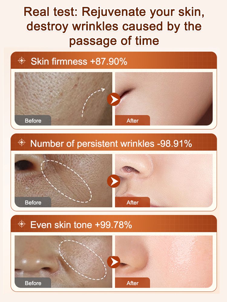 [Remove wrinkles in seconds] Ecdoin anti-aging essence