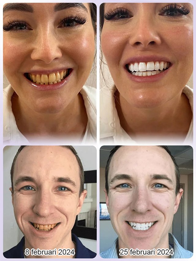 Tandherstel & Whitening Mineralen Tandpoeder