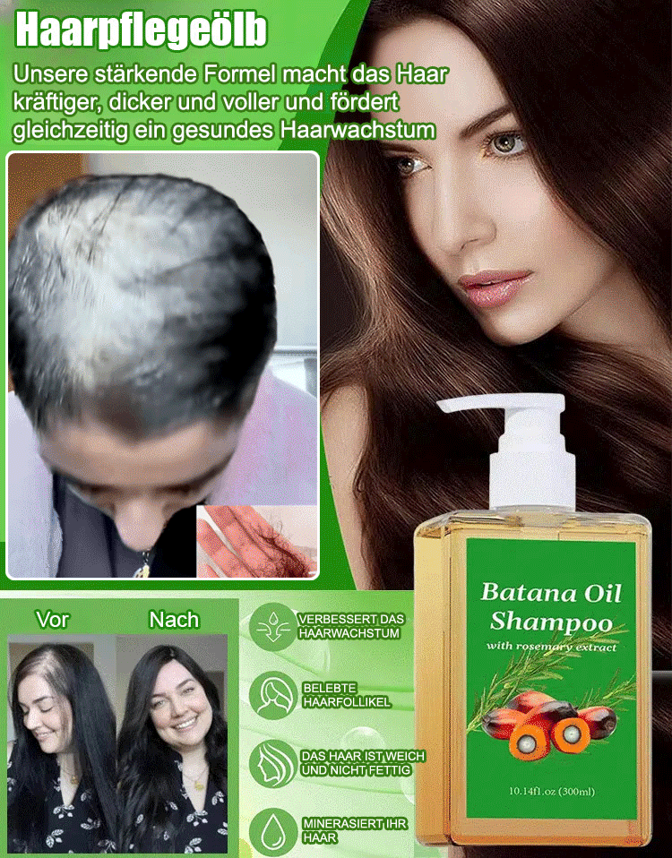【Rapid hair growth in 7 days!】Hair growth shampoo