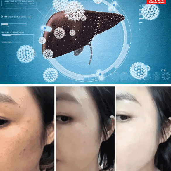 【Protección del hígado y reducción de lípidos】Tabletas de Pueraria y Ganoderma