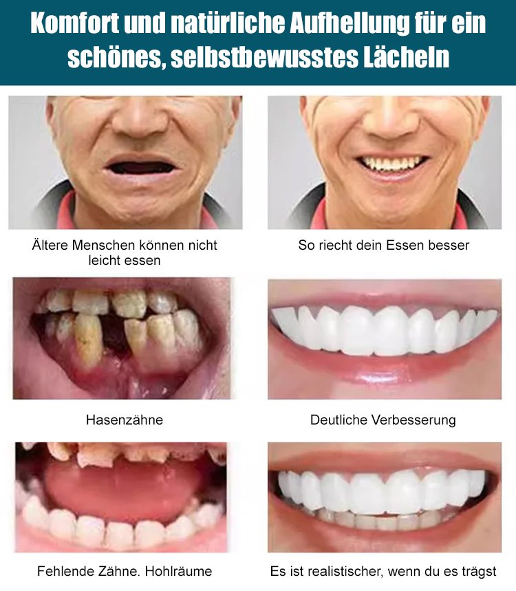 Verstellbare Schnappprothesen