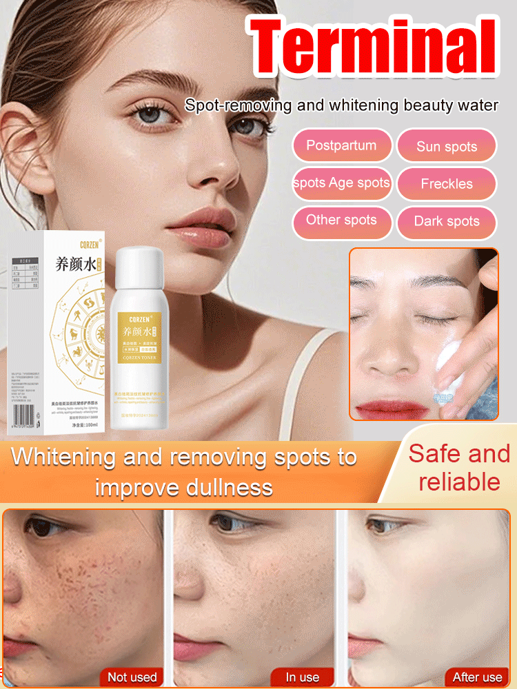 【All kinds of spots can be removed with one spray】Blemish removal, whitening and beauty water