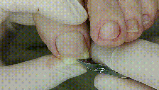 1.gif