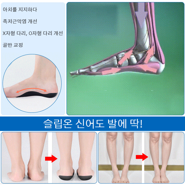 아치 지원 깔창