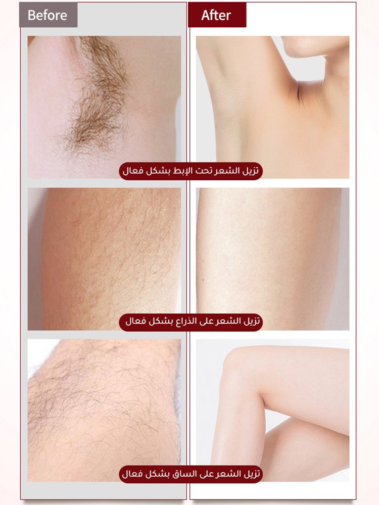 مجموعة ماكينات إزالة الشعر المتعددة الوظائف مكونة من 4 قطع للنساء من الماركة الألمانية 