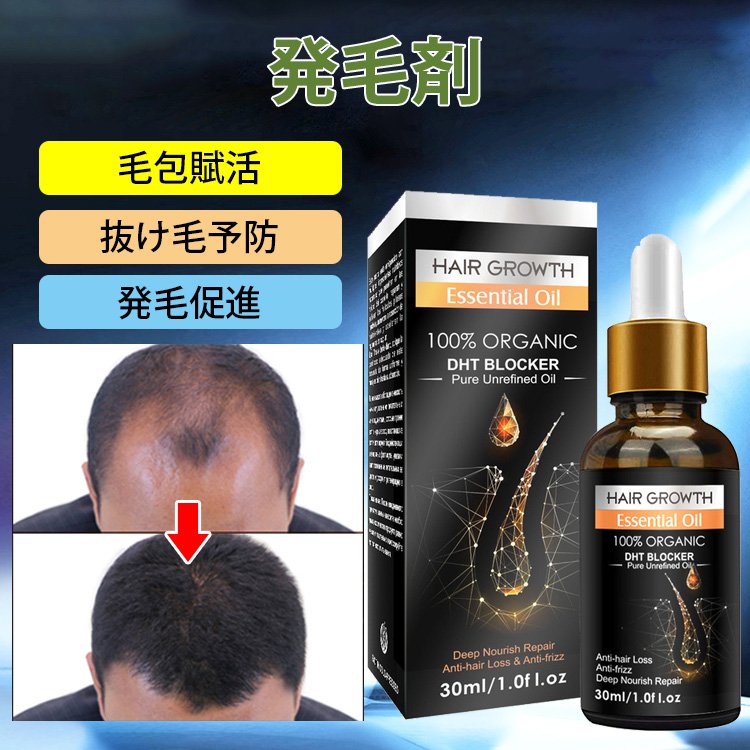 発毛剤