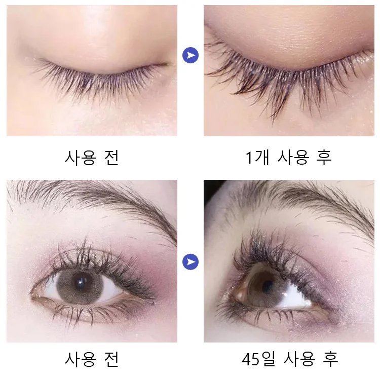 속눈썹 영양제