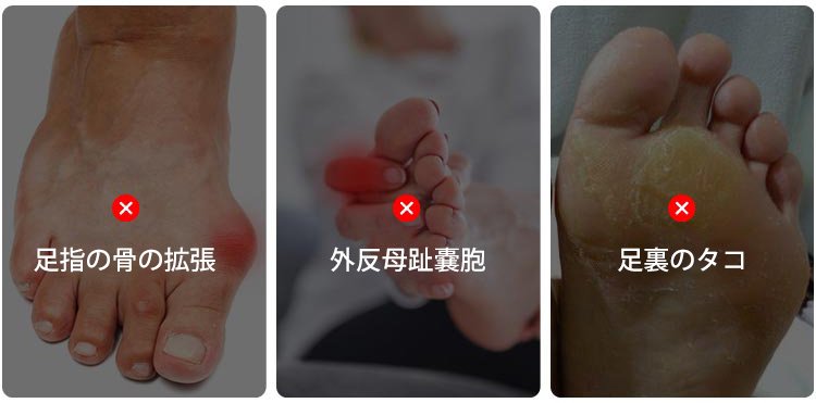最後の1時間は半額!【足の専門医が推薦】男女兼用矯正用5本指浅履きソックス、効果がなければ全額返金保証！ - detail 5