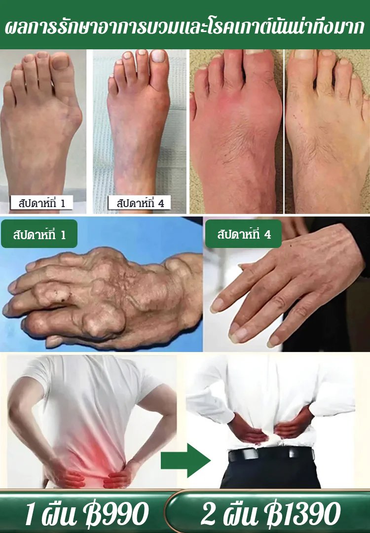 ผ้าห่มประคบร้อนบำบัดเฮียเฮียะ