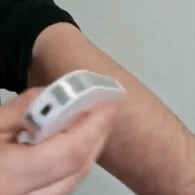 美容外科学会推薦！【男女兼用】スマート無痛脱毛機！脱毛・美肌・黒ずみケア