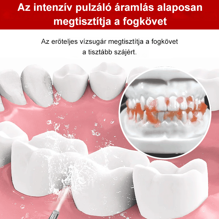 Hordozható elektromos fogkefe szájhigiéniai eszköz