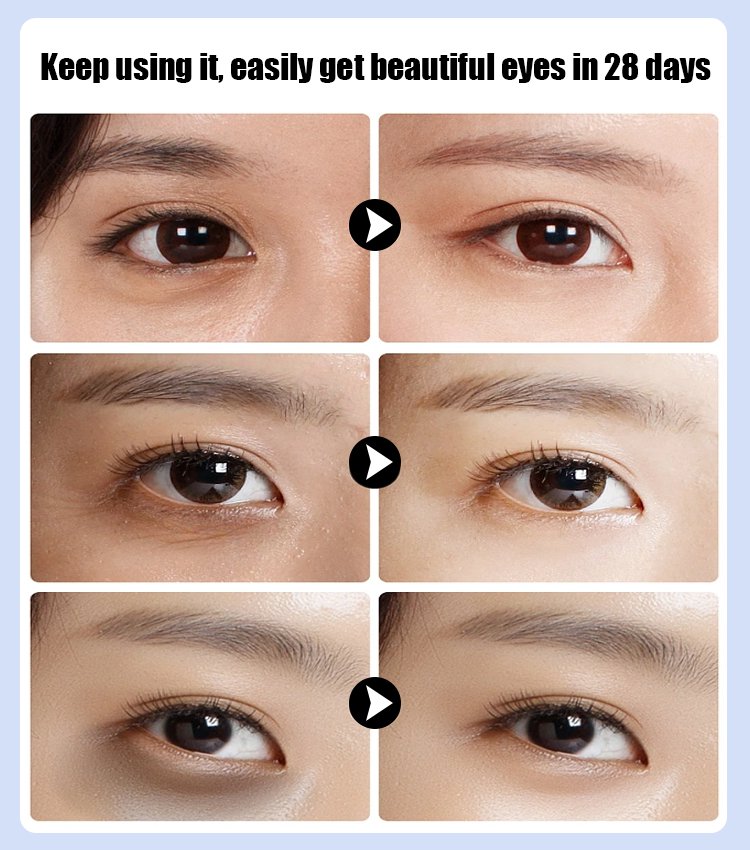 Eye Care Device