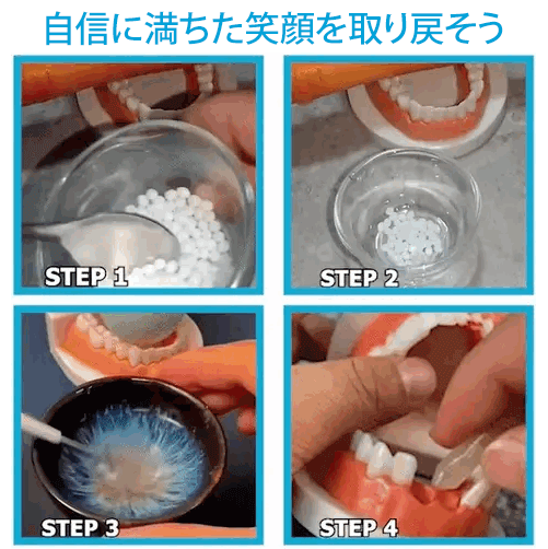 South Moon歯用接着剤