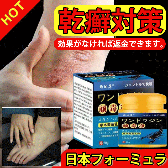 乾癬対策クリーム