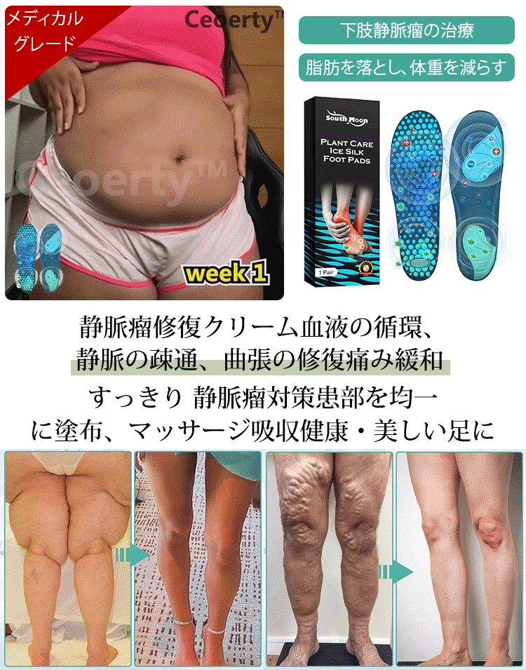 アイスシルク医療用インソール