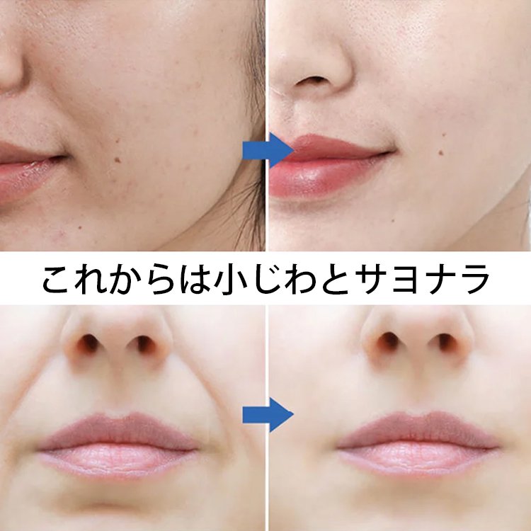 微結晶配合ほうれい線対策パッチ