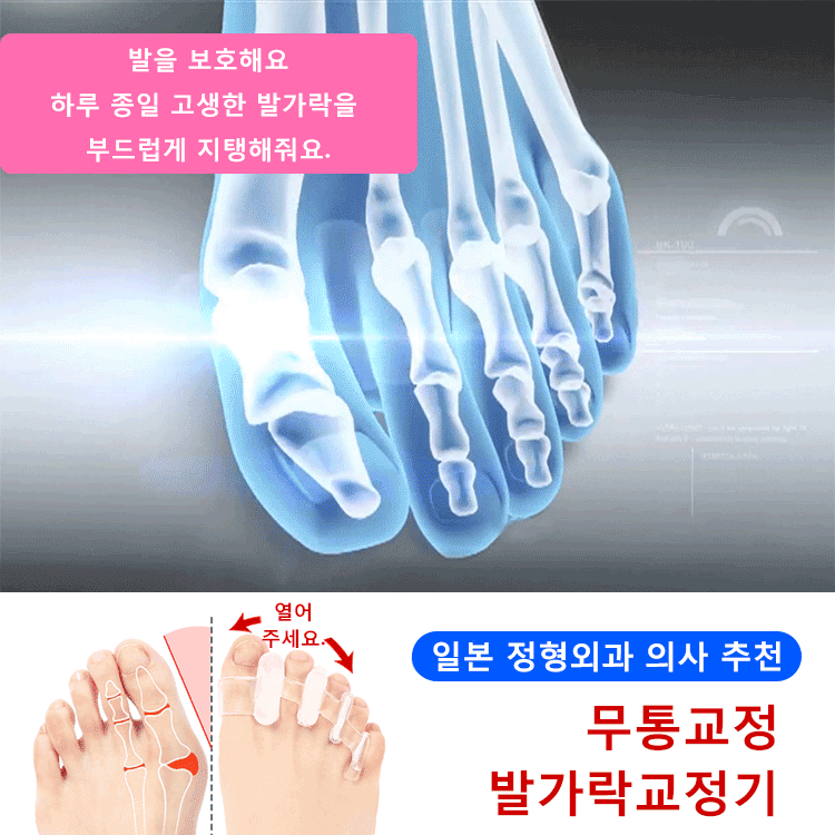 실리콘 발가락 교정기