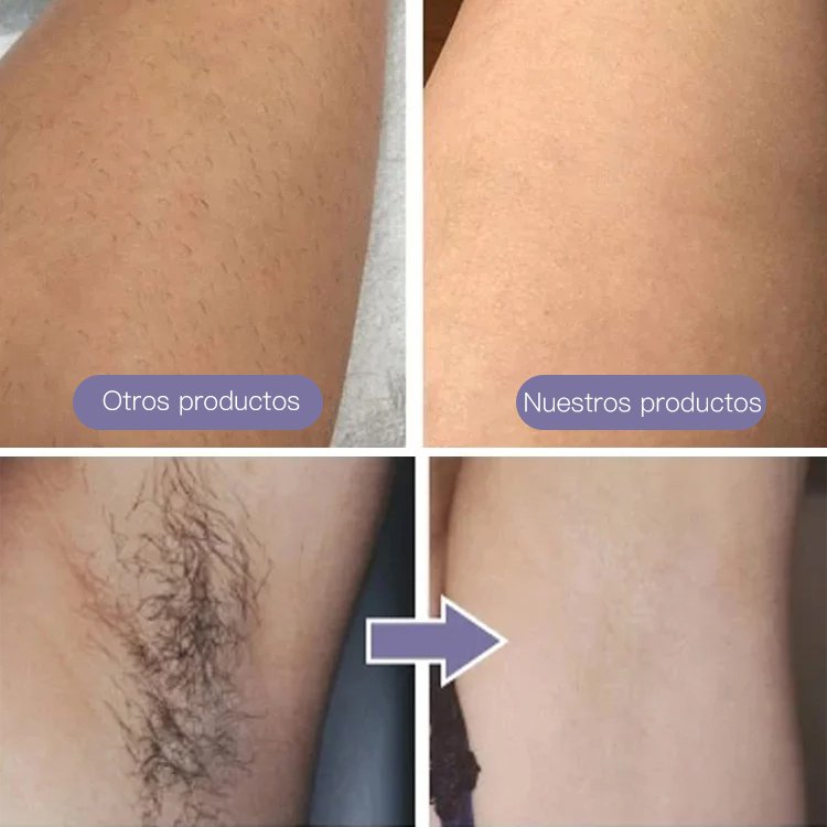 Aparato portátil de depilación de partes íntimas de dos cabezas con láser