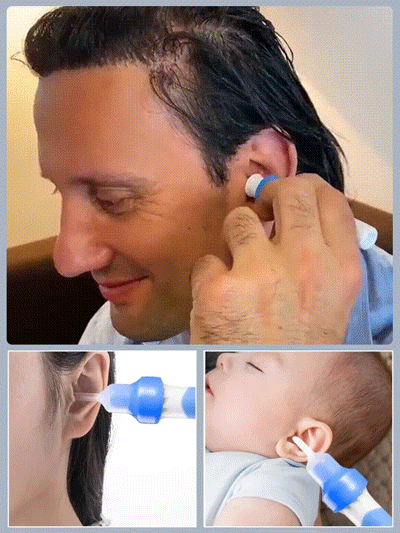 Elektryczny odciągacz woskowiny usznejOdciągacz woskowiny usznej