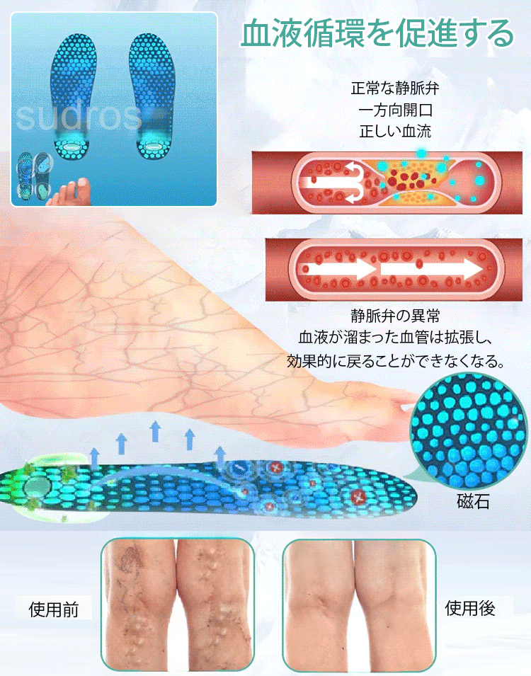 アイスシルク医療用インソール